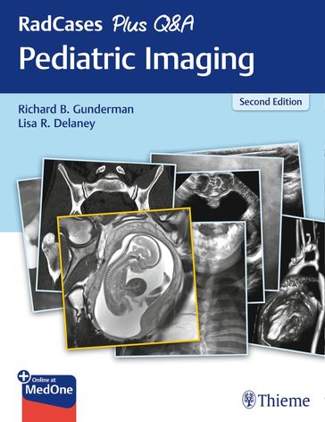 RadCases Plus Q&A Pediatric Imaging - Richard B. Gunderman - Lisa Delaney