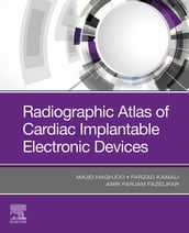 Radiographic Atlas of Cardiac Implantable Electronic Devices - E-Book