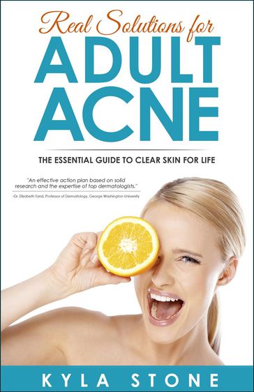 Real Solutions for Adult Acne - Kyla Stone