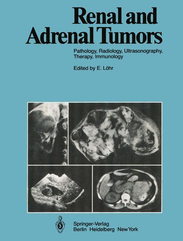 Renal and Adrenal Tumors - A. Baert - A. Moss - B. Swart - C. Stambolis - D. Bachmann - D. Beyer - E. Boijsen - E. Lohr - E. Scherer - G. Marchal - Guido Wilms - H. Behrendt - H. Holfeld - H.C. Dominick - H.J. Richter - J.V. Kaude - L. Jeanmart - L.D. Leder - M. Georgi - M. Goldberg - M. Marberger - M. Osteaux - M.W. Strotges - O. Olsson - P. Mellin - R. ACKERMAN - R. Gunther - R. Heckmann - U. Goerttler - V. Fiedler - W. Bischoff - W. Havers - W.A. Fuchs