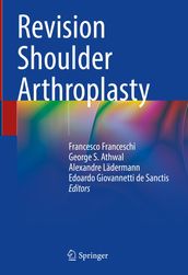 Revision Shoulder Arthroplasty