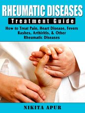 Rheumatic Disease Treatment Guide