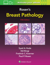 Rosen s Breast Pathology