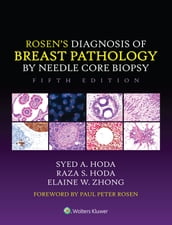 Rosen s Diagnosis of Breast Pathology by Needle Core Biopsy