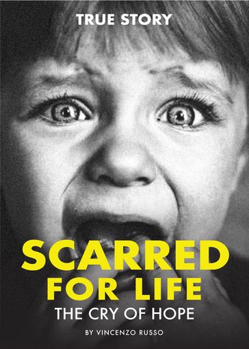 SCARRED FOR LIFE - Vincenzo Russo