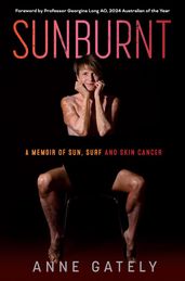 SUNBURNT. A memoir of sun, surf and skin cancer