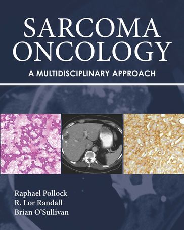 Sarcoma Oncology