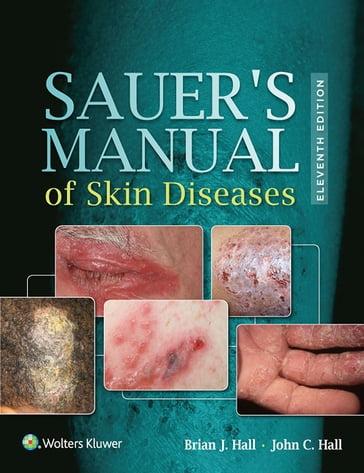 Sauer's Manual of Skin Diseases - Brian J. Hall - John C. Hall