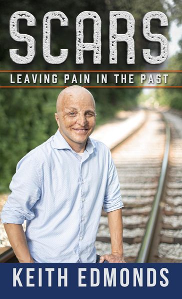 Scars Leaving Pain in the Past - Keith Edmonds