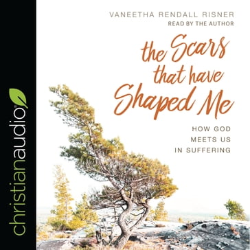 Scars That Have Shaped Me - Vaneetha Rendall Risner