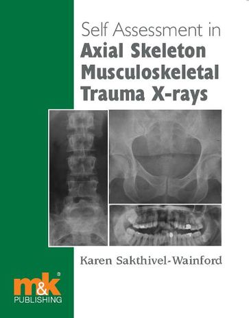 Self-assessment in Axial Musculoskeletal Trauma X-rays - Karen Sakthivel-Wainford