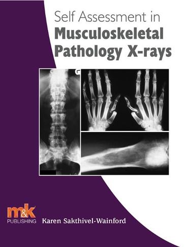 Self-assessment in Musculoskeletal Pathology X-rays - Karen Sakthivel-Wainford