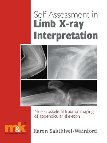 Self-assessment in Limb X-ray Interpretation - Karen Sakthivel-Wainford