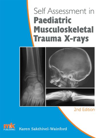 Self-assessment in Paediatric Musculoskeletal Trauma X-rays - Karen Sakthivel-Wainford