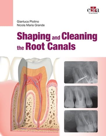 Shaping and Cleaning the Root Canals - Gianluca Plotino - Nicola Maria Grande