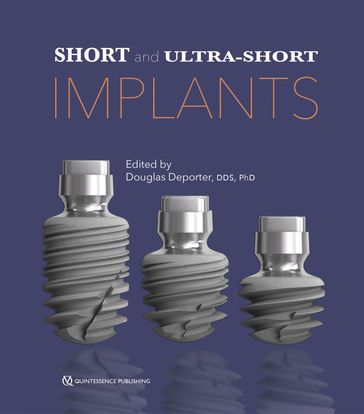 Short and Ultra-Short Implants - Douglas Deporter