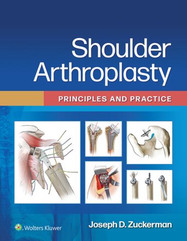 Shoulder Arthroplasty - Joseph D. Zuckerman