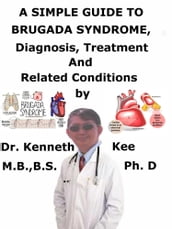 A Simple Guide to Brugada Syndrome, Diagnosis, Treatment and Related Conditions