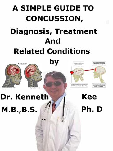 A Simple Guide to Concussion, Diagnosis, Treatment and Related Conditions - Kenneth Kee