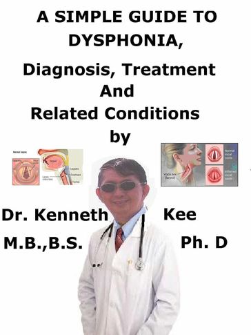 A Simple Guide to Dysphonia, Diagnosis, Treatment and Related Conditions - Kenneth Kee