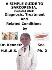 A Simple Guide to Sarcopenia, (Updated 2023) Diagnosis, Treatment and Related Conditions