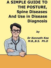 A Simple Guide to The Posture, Spine Diseases and Use in Disease Diagnosis