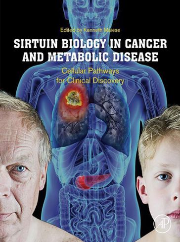 Sirtuin Biology in Cancer and Metabolic Disease - Elsevier Science