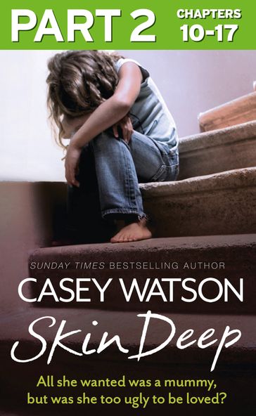 Skin Deep: Part 2 of 3: All she wanted was a mummy, but was she too ugly to be loved? - Casey Watson