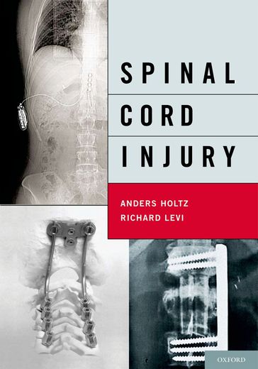 Spinal Cord Injury - MD  PhD Anders Holtz - MD  PhD Richard Levi