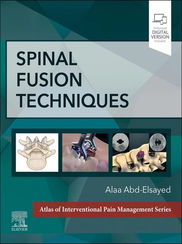 Spinal Fusion Techniques - E-Book - Alaa Abd-Elsayed - MD - MPH - FASA