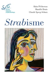 Strabisme