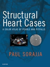 Structural Heart Cases E-Book