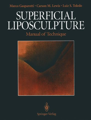 Superficial Liposculpture - Carson M. Lewis - Luiz S. Toledo - Marco Gasparotti