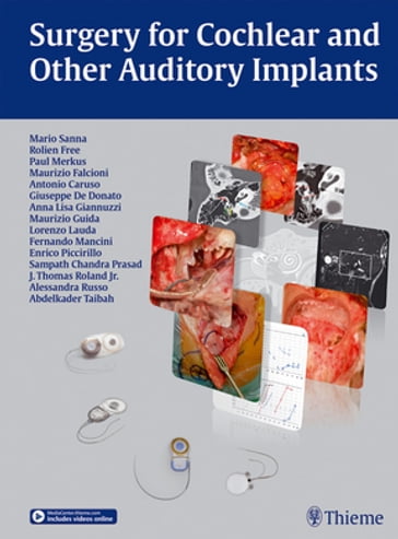Surgery for Cochlear and Other Auditory Implants - Mario Sanna - Rolien H. Free - Paul Merkus - Maurizio Falcioni