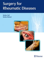 Surgery for Rheumatic Diseases