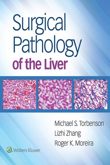 Surgical Pathology of the Liver - Lizhi Zhang - Michael Torbenson - Roger Moreira