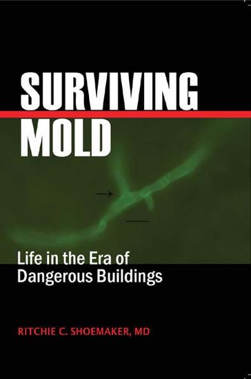 Surviving Mold - MD Ritchie C. Shoemaker