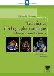 Techniques d échographie cardiaque