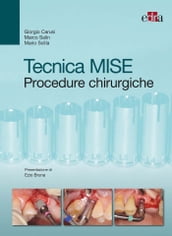 Tecnica MISE