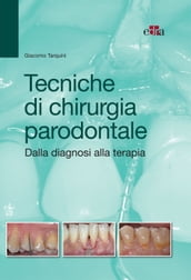 Tecniche di chirurgia parodontale