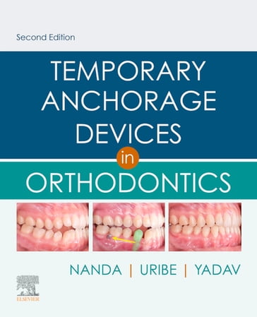 Temporary Anchorage Devices in Orthodontics E-Book - BDS  MDS  PhD Ravindra Nanda - BDS  MDS  PhD Sumit Yadav - DDS  MDentSc Flavio Andres Uribe