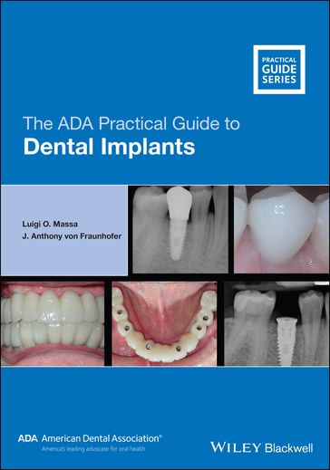 The ADA Practical Guide to Dental Implants - Luigi O. Massa - J. Anthony von Fraunhofer