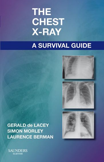 The Chest X-Ray: A Survival Guide - MA  FRCR Gerald de Lacey - MB  BS  FRCP  FRCR Laurence Berman - FRCR Simon Morley