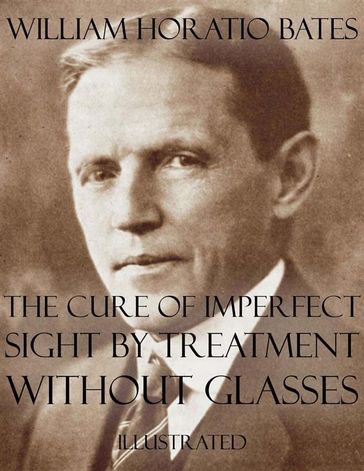 The Cure of Imperfect Sight by Treatment Without Glasses: Illustrated - William Horatio Bates