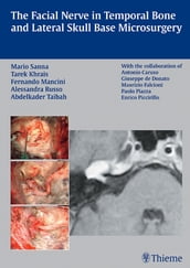 The Facial Nerve in Temporal Bone and Lateral Skull Base Microsurgery