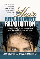 The Hair Replacement Revolution