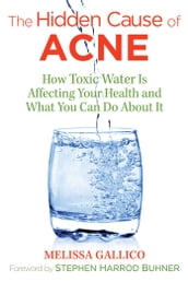 The Hidden Cause of Acne