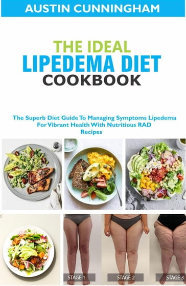 The Ideal Lipedema Diet Cookbook; The Superb Diet Guide To Managing Symptoms Lipedema For Vibrant Health With Nutritious RAD Recipes - Austin Cunningham