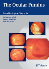 The Ocular Fundus