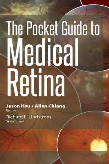 The Pocket Guide to Medical Retina - Jason Hsu - Allen Chiang